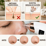 Comparativa de la piel antes y después del extractor de puntos negros
