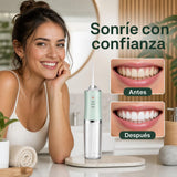 Resultado de una sonrisa cuidada con el irrigador dental