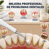 Problemas dentales que ayuda a tratar el limpiador ultrasónico